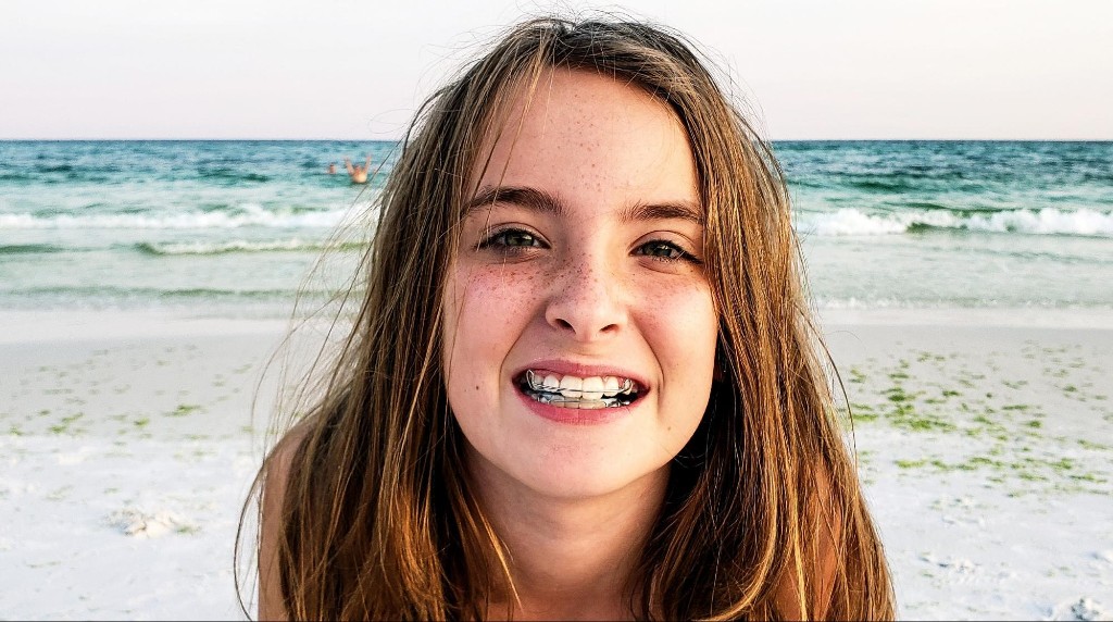 What are orthodontic retainers?